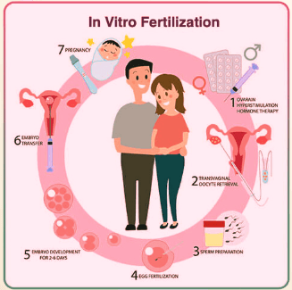 IVF